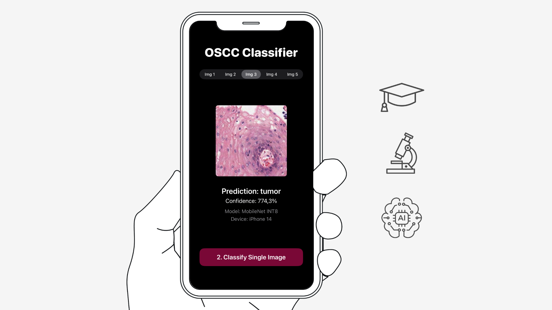 OSCC Classifier