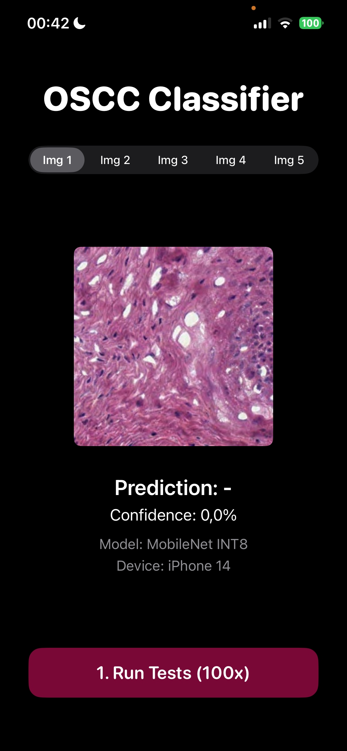 OSCC Classifier Screenshot
