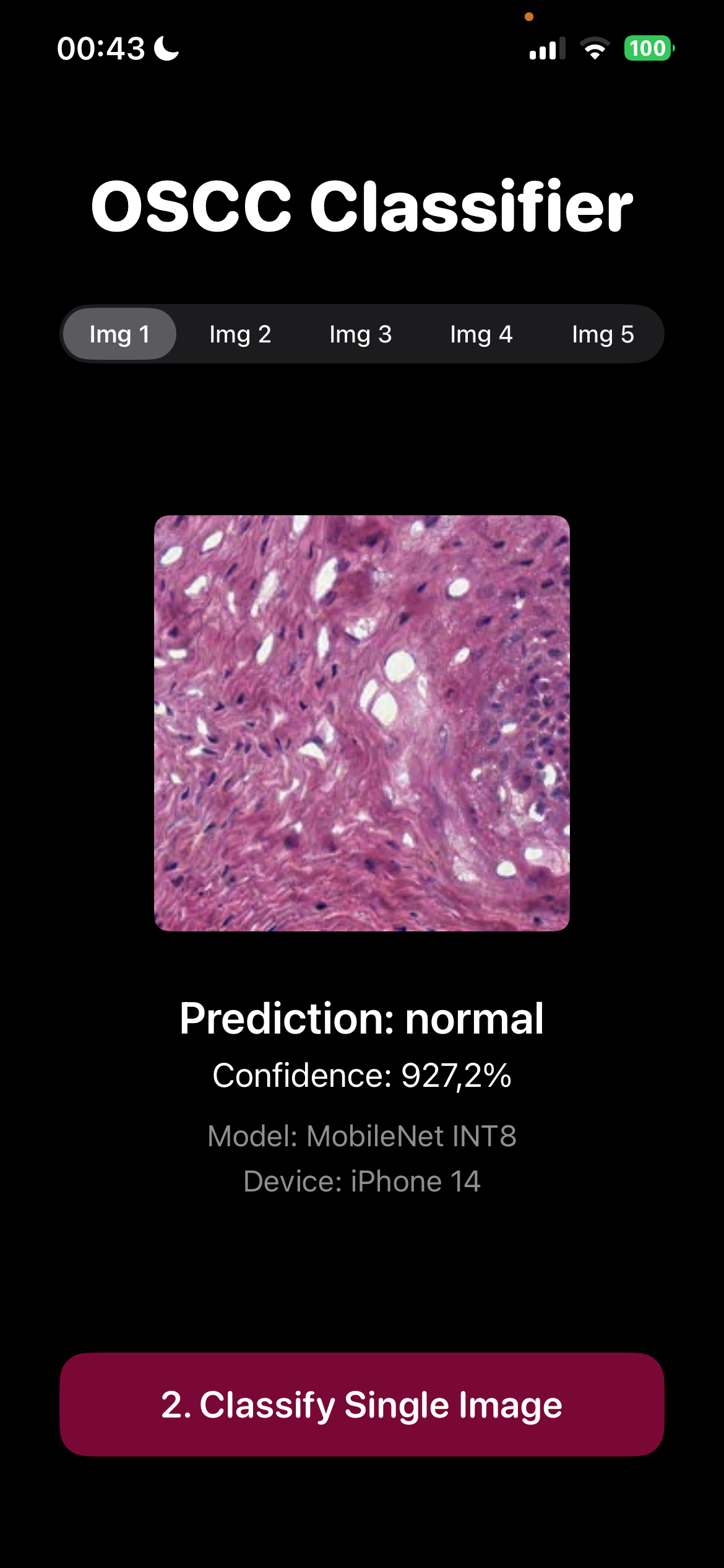 OSCC Classifier Screenshot