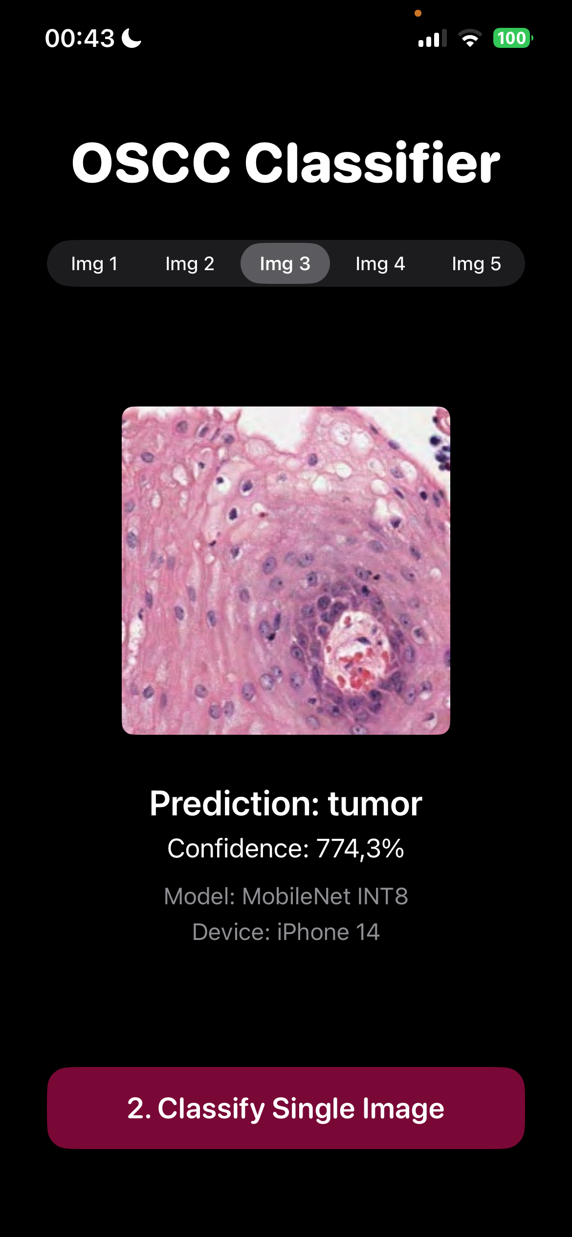 OSCC Classifier Screenshot
